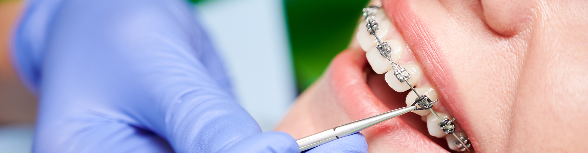 gloved hand using dental tool on mouth with braces